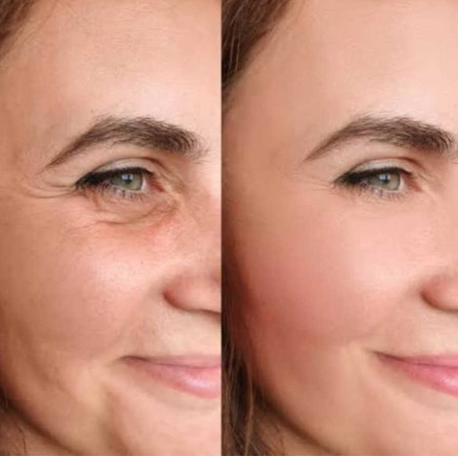 Resultado Estética Corporal - Antes e Depois