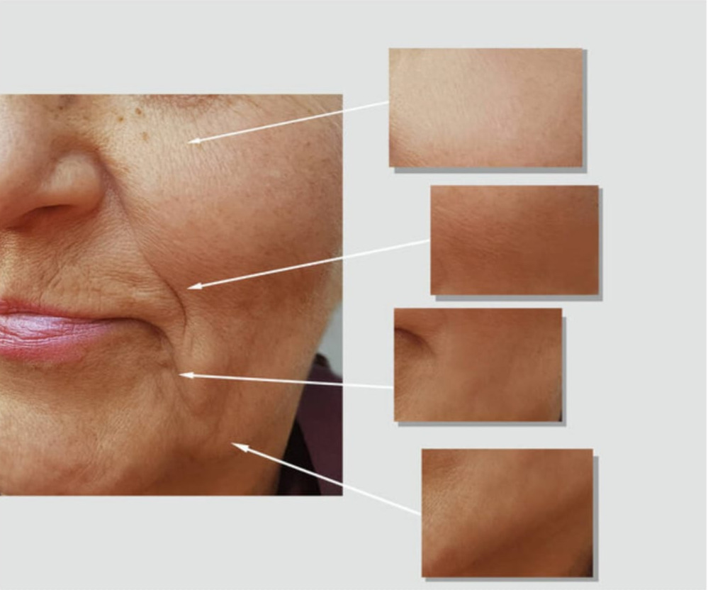 Resultado Procedimento Estético - Antes e Depois